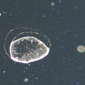 Water Spots Type I Type II Type III