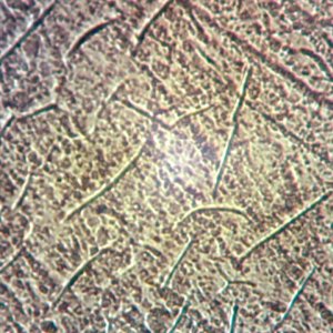 Headlight surface images