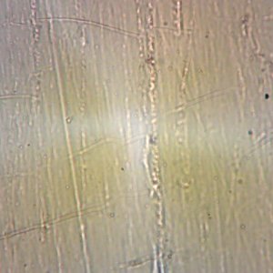 Headlight surface images