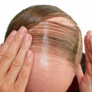 combover