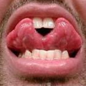 forked_tongue
