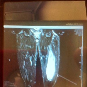 photo43