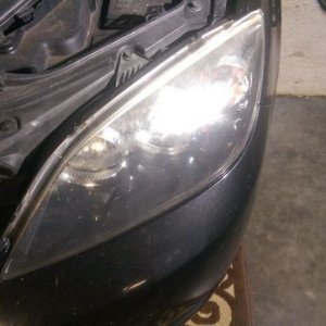 tn_right_hdlt_before