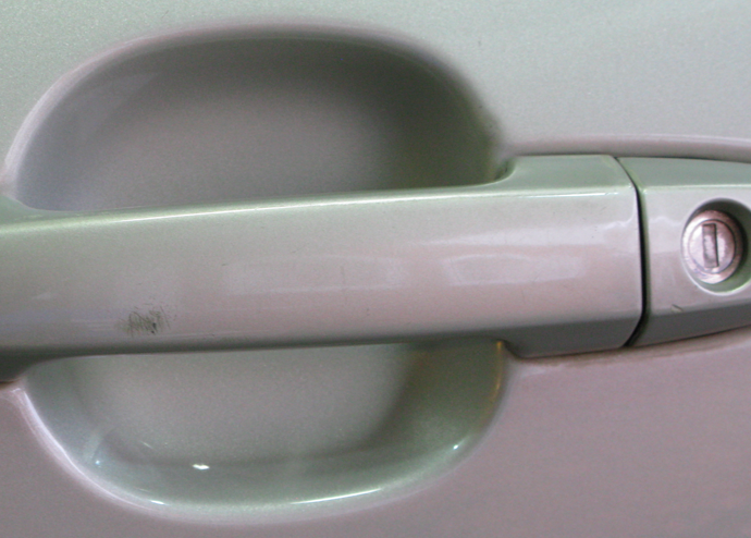 A1-handle