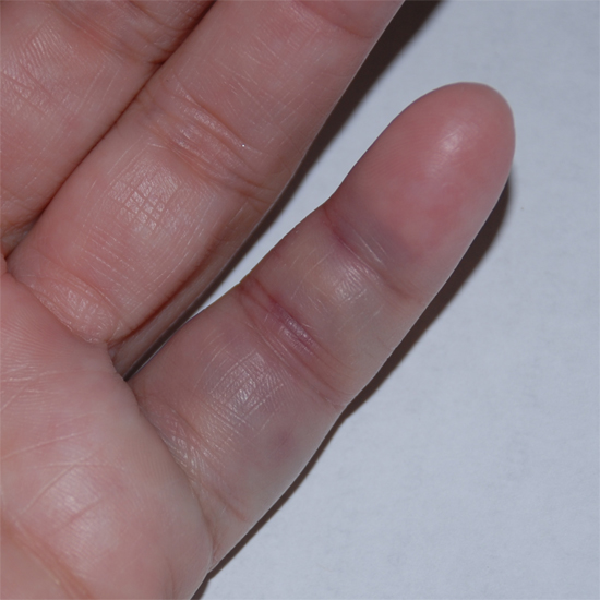 FINGER