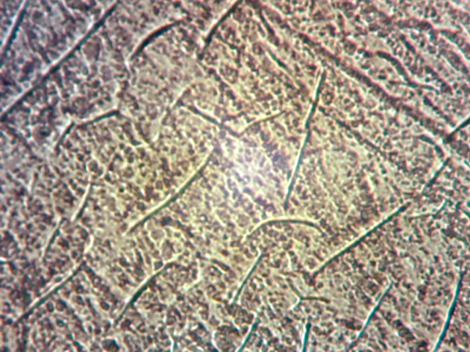 Headlight surface images