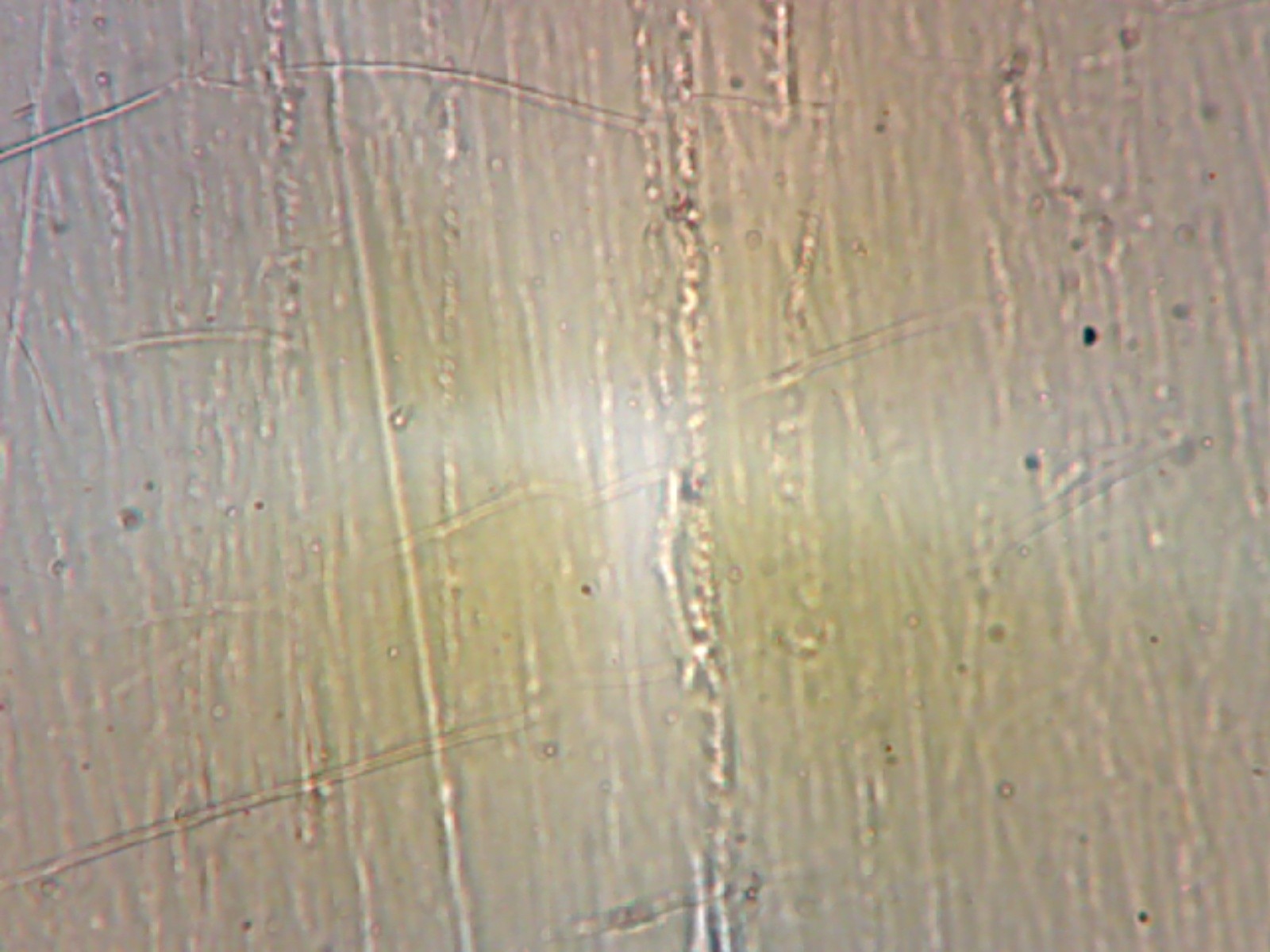 Headlight surface images