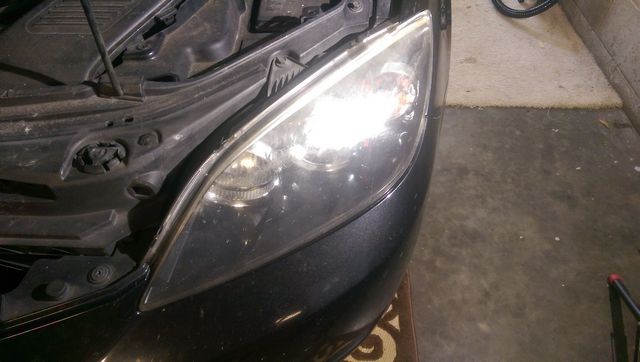 tn_right_hdlt_before