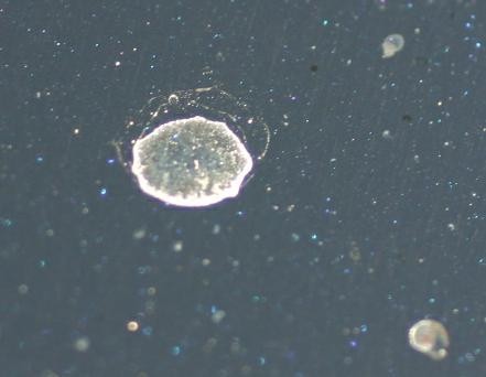 Water Spots Type I Type II Type III