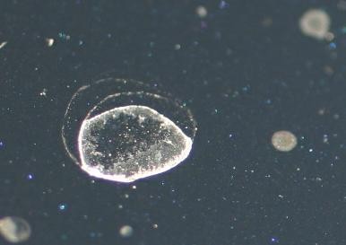 Water Spots Type I Type II Type III